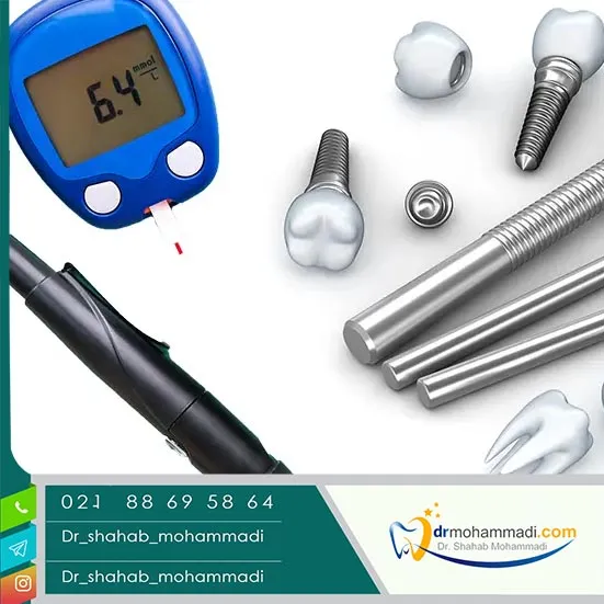 ایمپلنت برای افراد دیابتی: آیا ممکن است؟